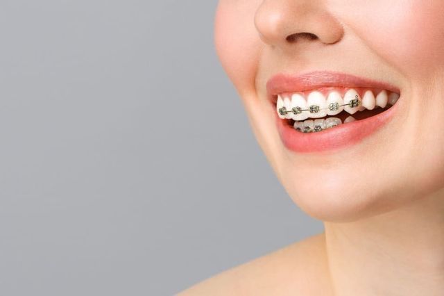 mujer con ortodoncia
